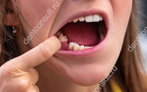 Как целостность зубного ряда сказывается на здоровье