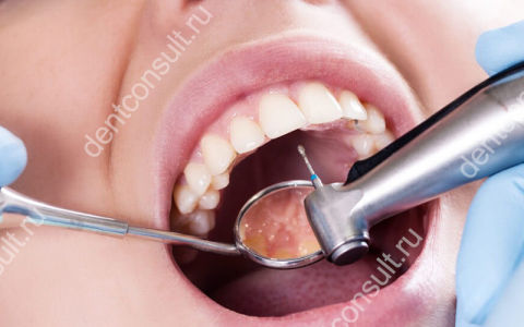 Можно ли получить травму во время лечения зубов?