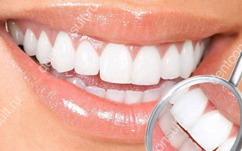 Можно ли отбеливать зубы с имплантами