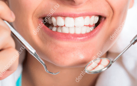 Полный обзор современных методов реставрации зубов: вкладки, виниры, люминиры