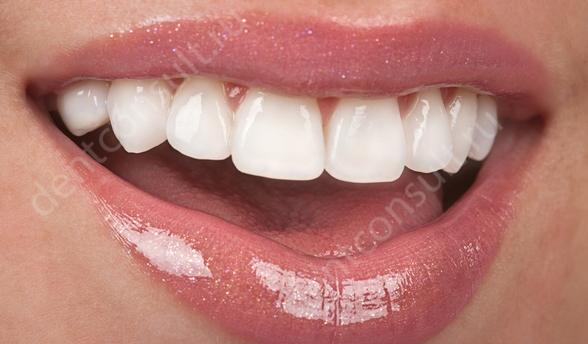 Красивые зубы