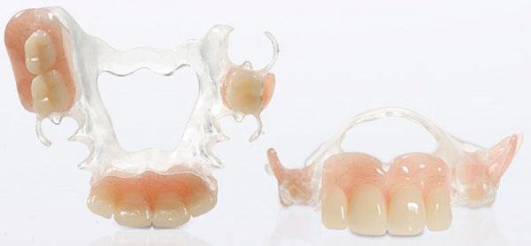 Материалы для протезирования зубов что лучше