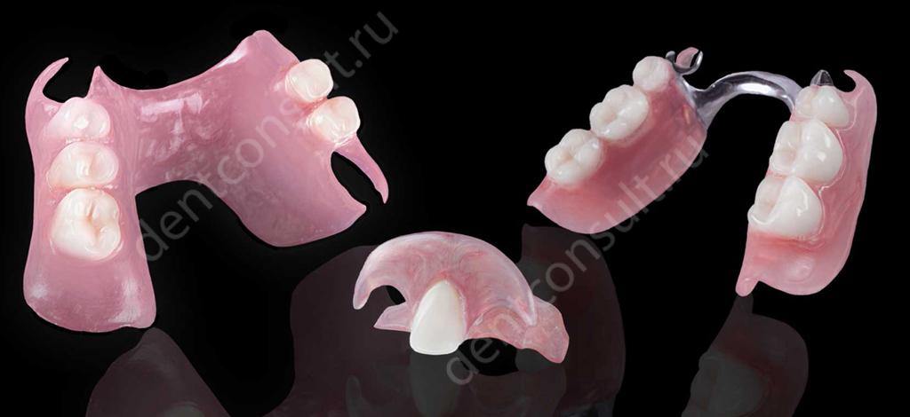 Зубные протезы съемные при частичном отсутствии зубов