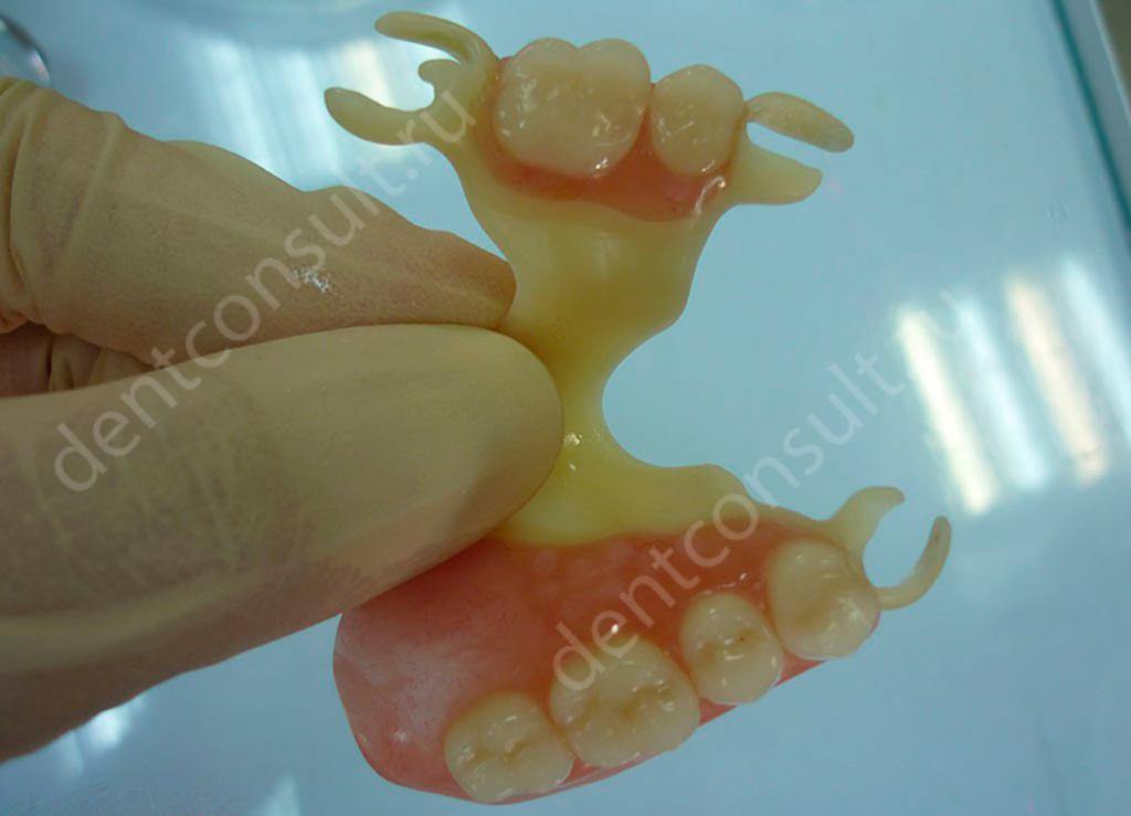 Зубные протезы Квадротти