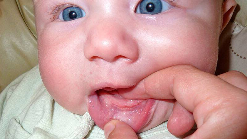 При прорезывании зубов у младенцев как облегчить боль: гели и мази для десен