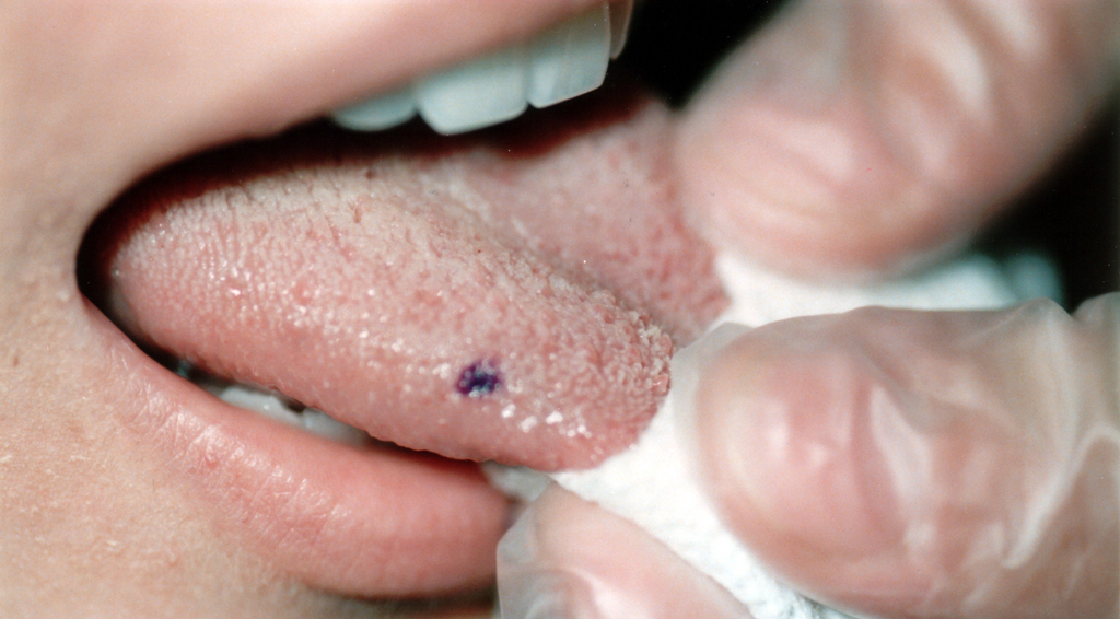 Травма языка может вызвать зуд