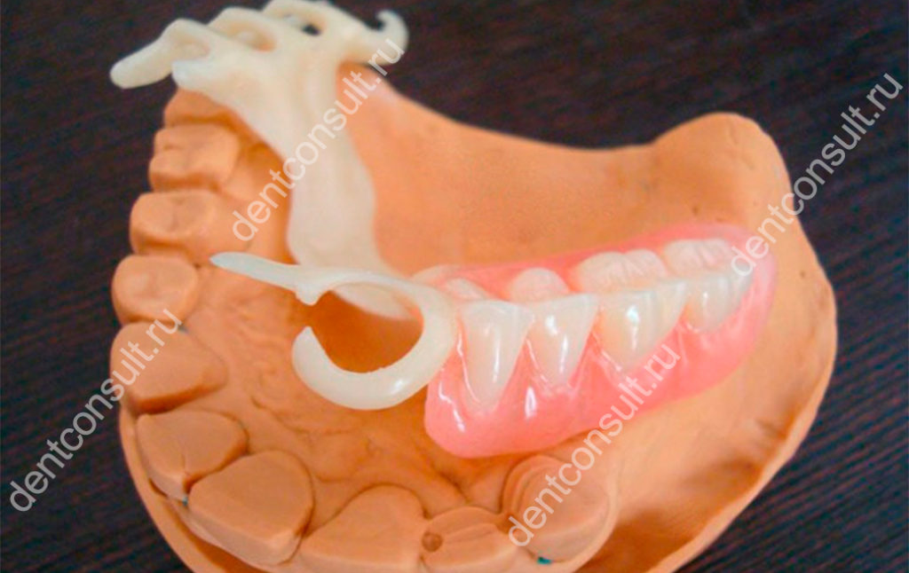 Ацеталовые зубные протезы