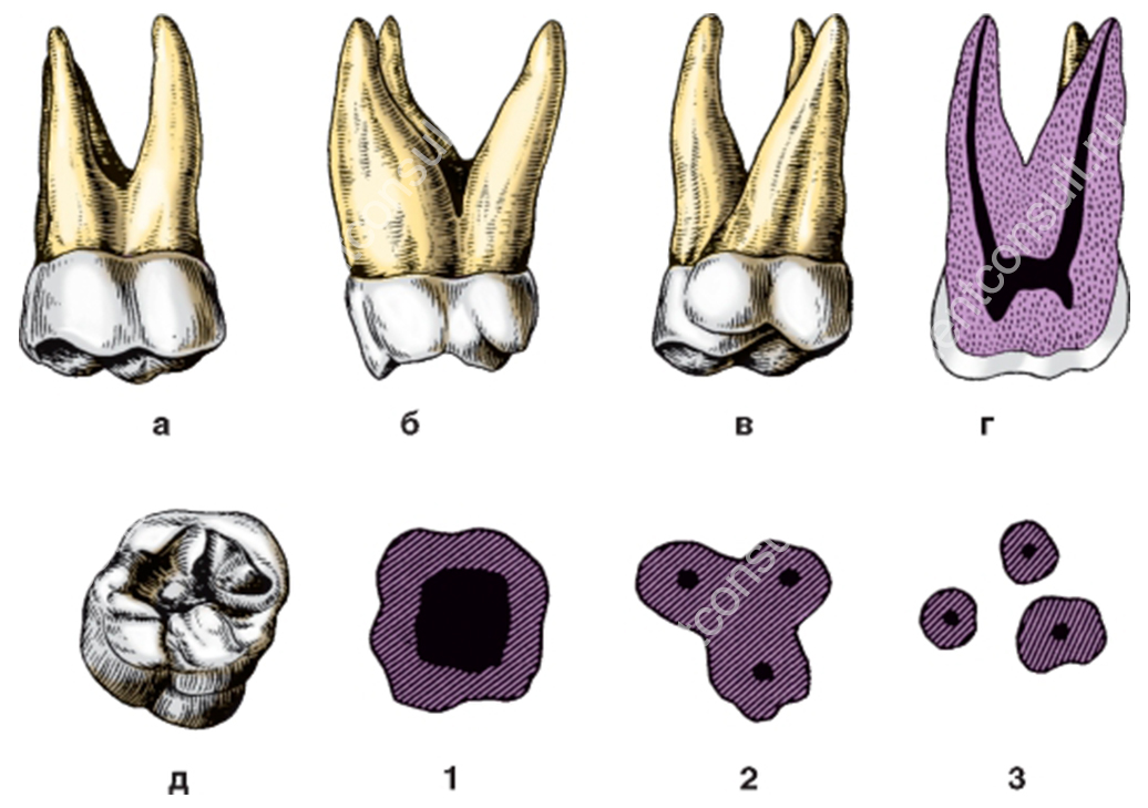 Коренной зуб в челюсти. Первый моляр верхней челюсти. Первый моляр верхней челюсти анатомия. Анатомия 1 верхнего моляра.