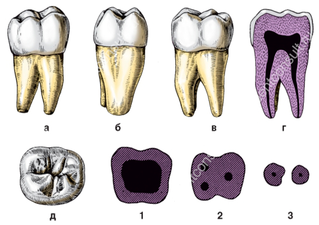 Удаление зуба семерки. Анатомия третьего моляра нижней челюсти. Зуб первый моляр нижней челюсти. Первый моляр нижней челюсти анатомия. Третьего моляра верхней челюсти.