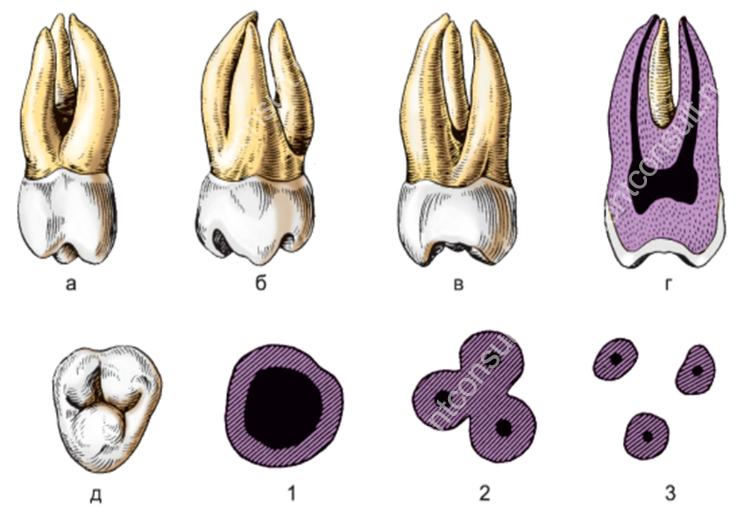 Зуб 1.4. 3 Моляр верхней челюсти анатомия. Третий верхний моляр анатомия. 3 Моляр нижней челюсти анатомия. 1 Моляр верхней челюсти анатомия.