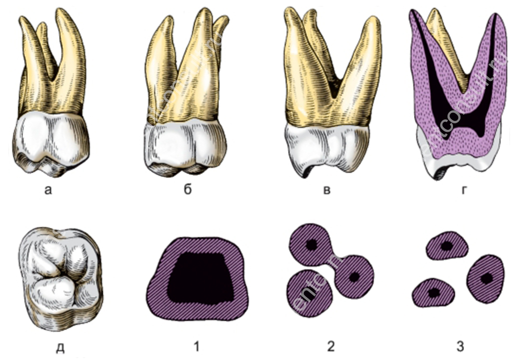 Коренные зубы вторым. Молочный второй моляр верхней челюсти. Второй моляр верхней челюсти анатомия. Моляры верхней челюсти анатомия. Второго моляра (7-й зуб).