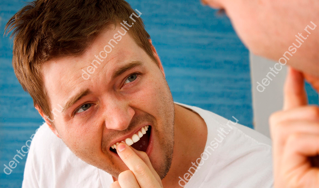 Как укрепить зубы, чтобы не шатались