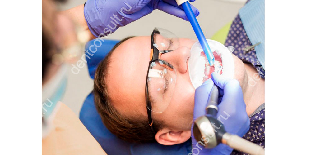 абразивную обработку видимой части зубов и пришеечной области с применением аппарата Air-Flow