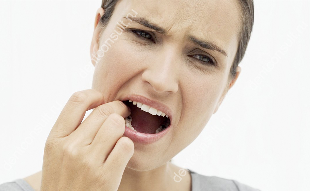Дополнительно пациенты стоматологии отмечают щелчки и хруст челюсти, блокировку рта, боль в голове и шее, шум в ушах, нарушение осанки