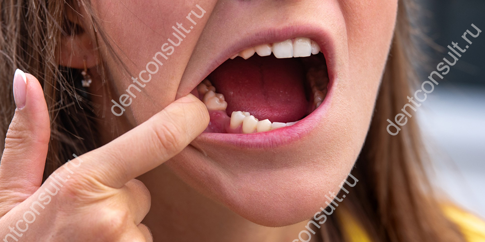 Как целостность зубного ряда сказывается на здоровье