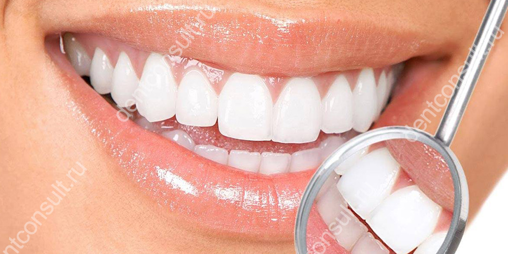 Можно ли отбеливать зубы с имплантами