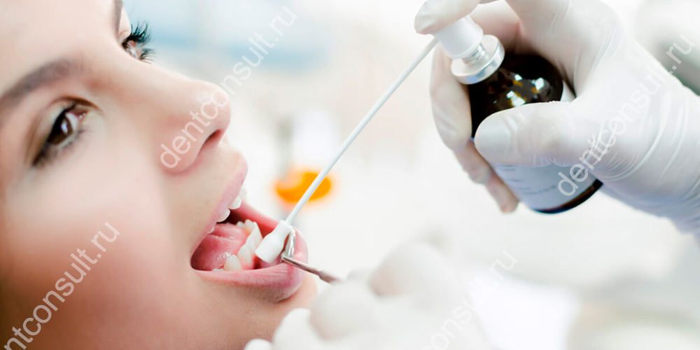 При ранних формах кариеса зубов лечение без реставрации абсолютно безболезненно